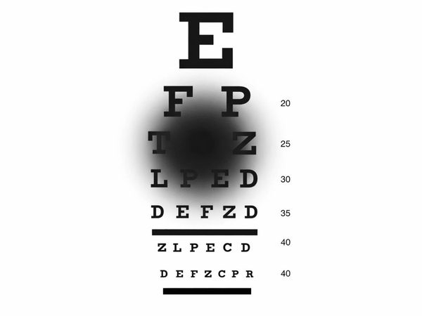 Eye chart with a dark spot obscuring part of the letters